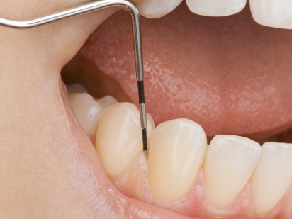 Periodontological Treatments