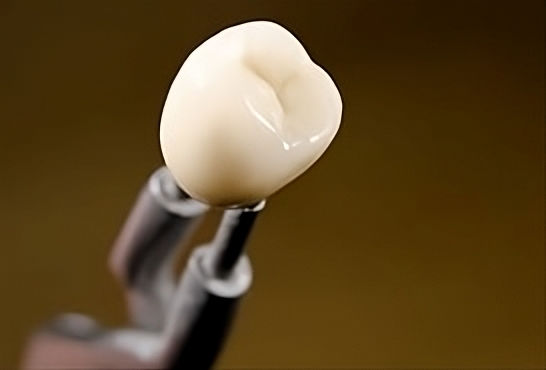 dental crowns 