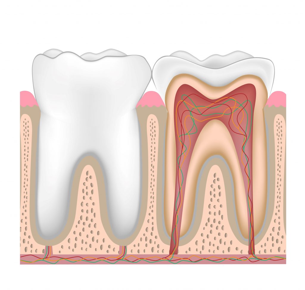 nerve damage due to dental implant 