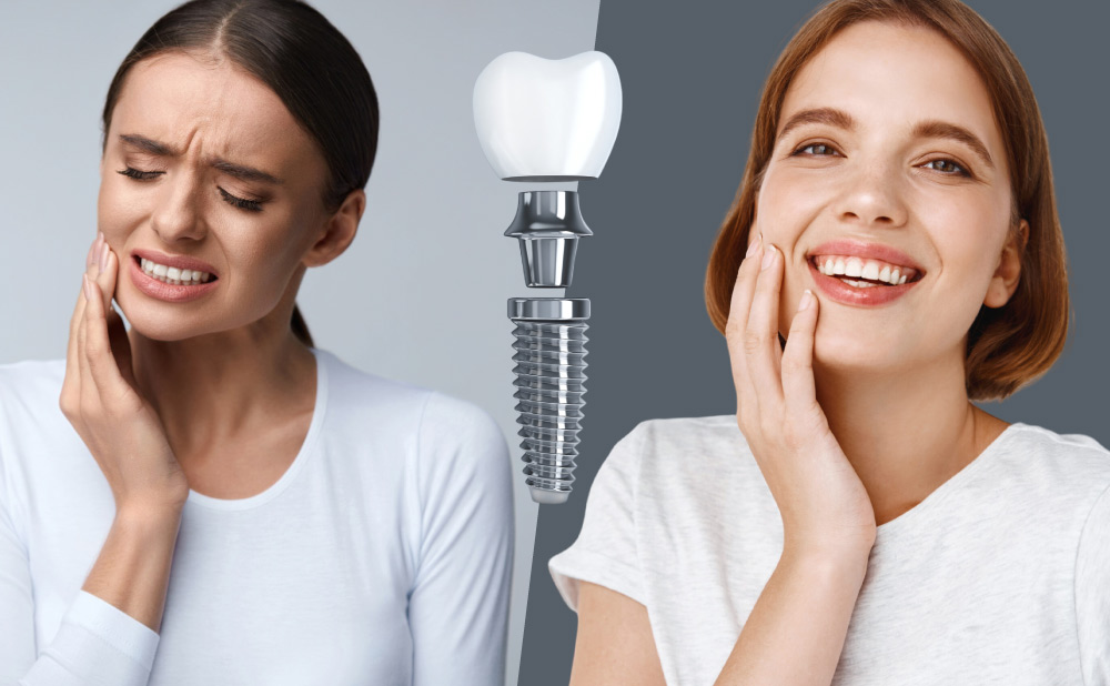 Discover why dental implants are not for you