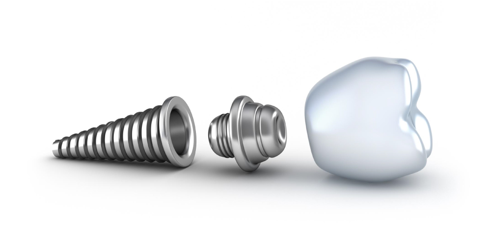 Parts of a dental implant.