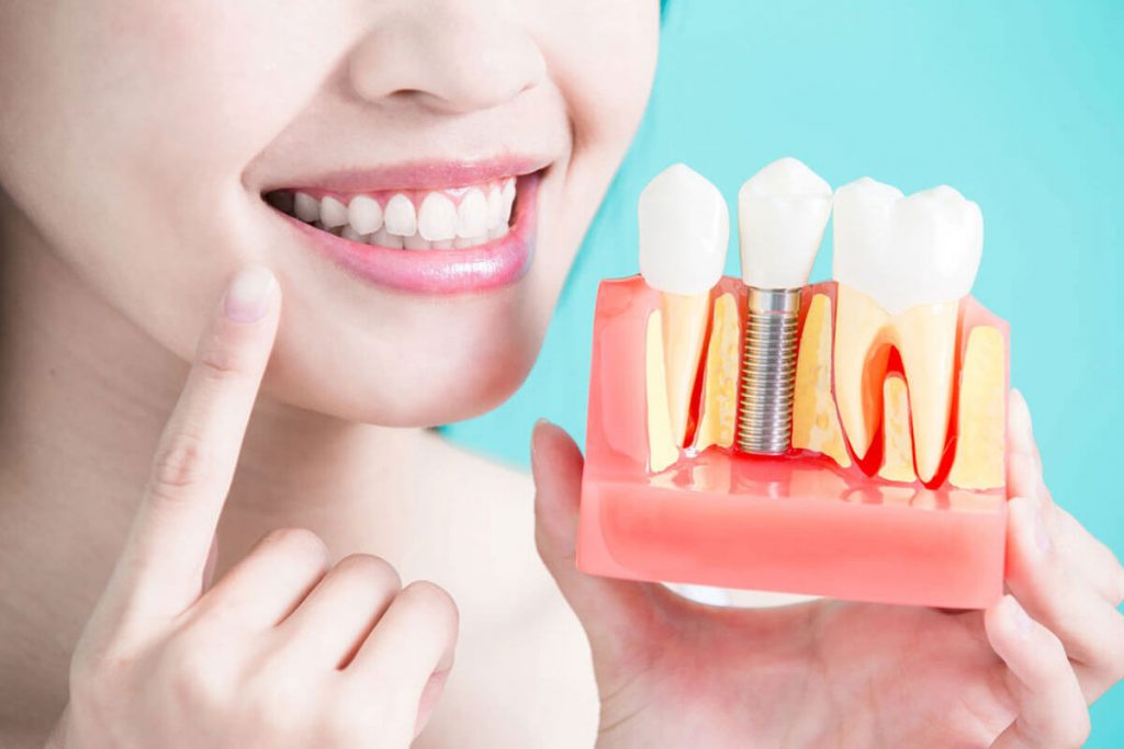 An image depicting a healthy candidate for dental implants.