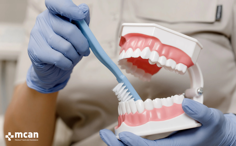 What to Expect After All on 6 Dental Implants: Recovery and Long-Term Care 2 All on 6 Dental Implant Recovery in the First Week - MCAN Dental