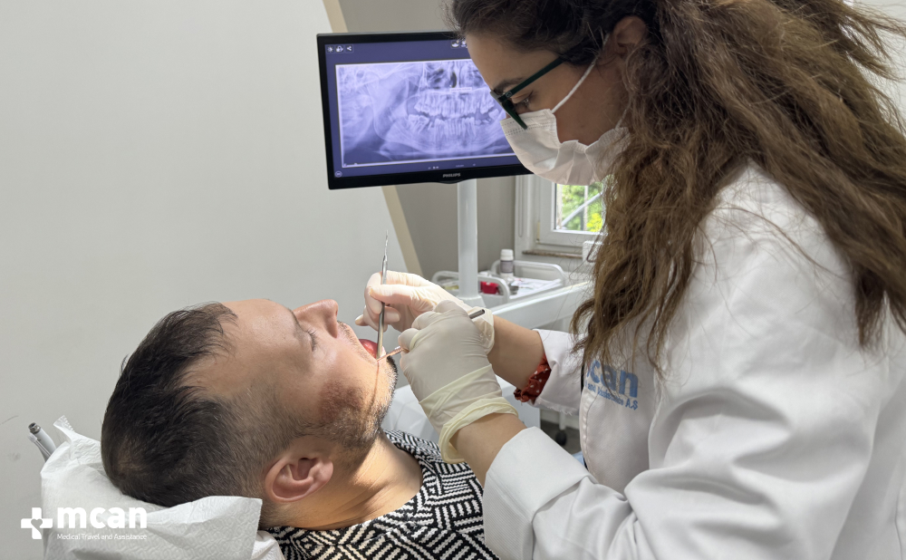 Hollywood Smile in Turkey: What’s Included and Is It Right for You? 4 How Long Does a Hollywood Smile Last - MCAN Dental