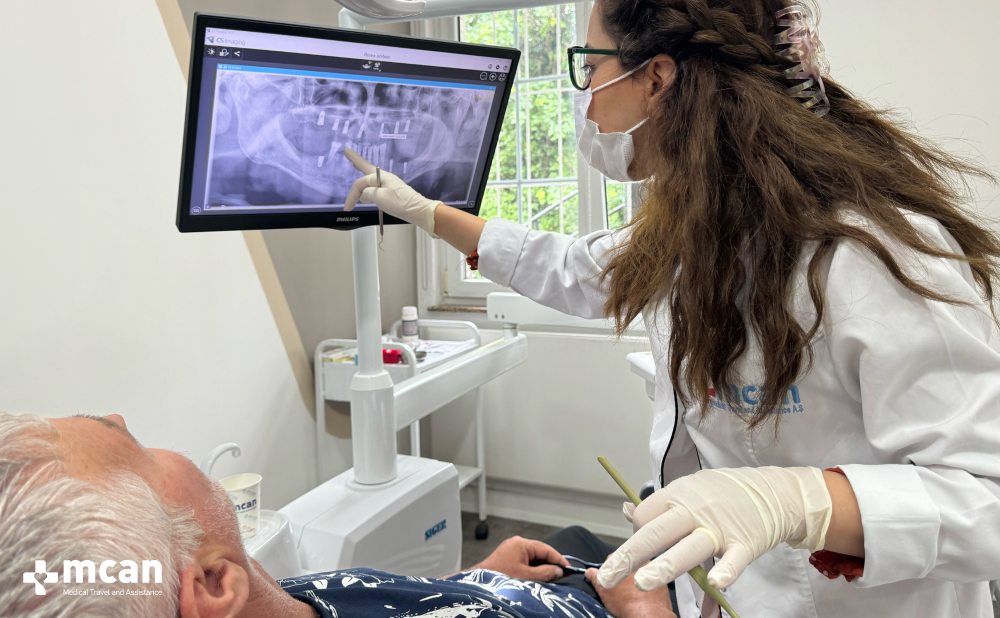 Zirconia vs. Emax Crowns: Which One Offers the Best Aesthetics? 4 When to Choose Zirconia vs. - MCAN Dental