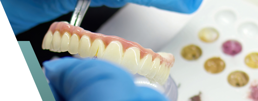 Full Mouth Implant cover - MCAN Dental