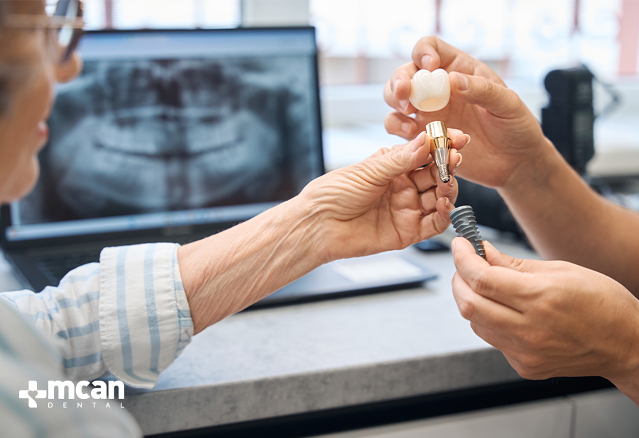 When Is It Too Late for a Tooth Implant - MCAN Dental