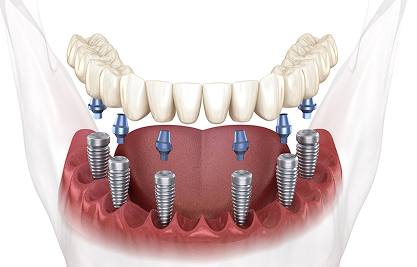image 2 - MCAN Dental