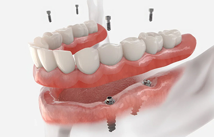 image 3 - MCAN Dental