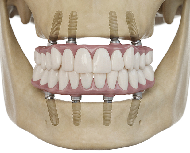image 4 - MCAN Dental