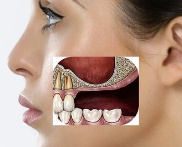 who is suitable 1 - MCAN Dental