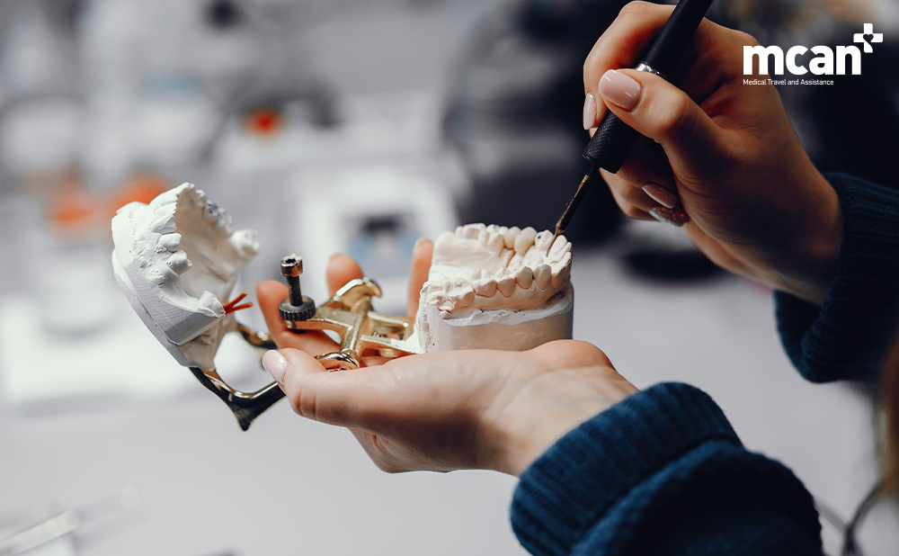All on 4 vs. All on 6 Dental Implants: Which Full-Arch Solution Should You Choose? 4 Longevity Functionality and Comfort in Daily Life - MCAN Dental