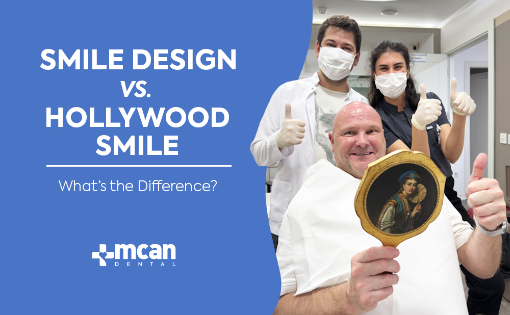 Smile Design vs. Hollywood Smile Cover - MCAN Dental