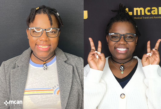 Smile Design vs. Hollywood Smile: What’s the Difference? 3 What Dental Issues Can Smile Design and Hollywood Smile Address - MCAN Dental
